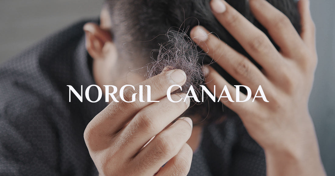 Stress et perte de cheveux, est-ce relié?