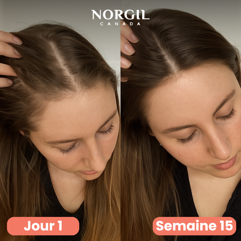 Traitement Repousse & Vitalité