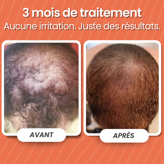 Programme Anti-chute et Repousse