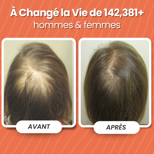 Programme Anti-chute et Repousse