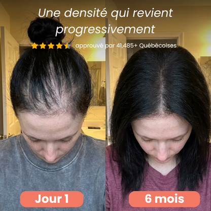 Traitement Repousse & Vitalité