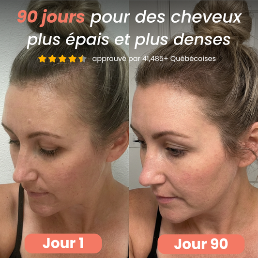 Solutions pour votre santé / beauté capillaire Norgil