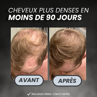 PROGRAMME ANTI-CHUTE ET REPOUSSE