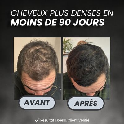 PROGRAMME ANTI-CHUTE ET REPOUSSE