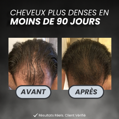PROGRAMME ANTI-CHUTE ET REPOUSSE