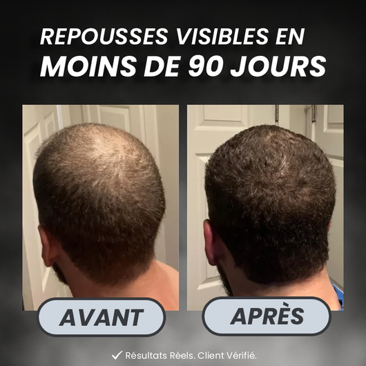 PROGRAMME ANTI-CHUTE ET REPOUSSE